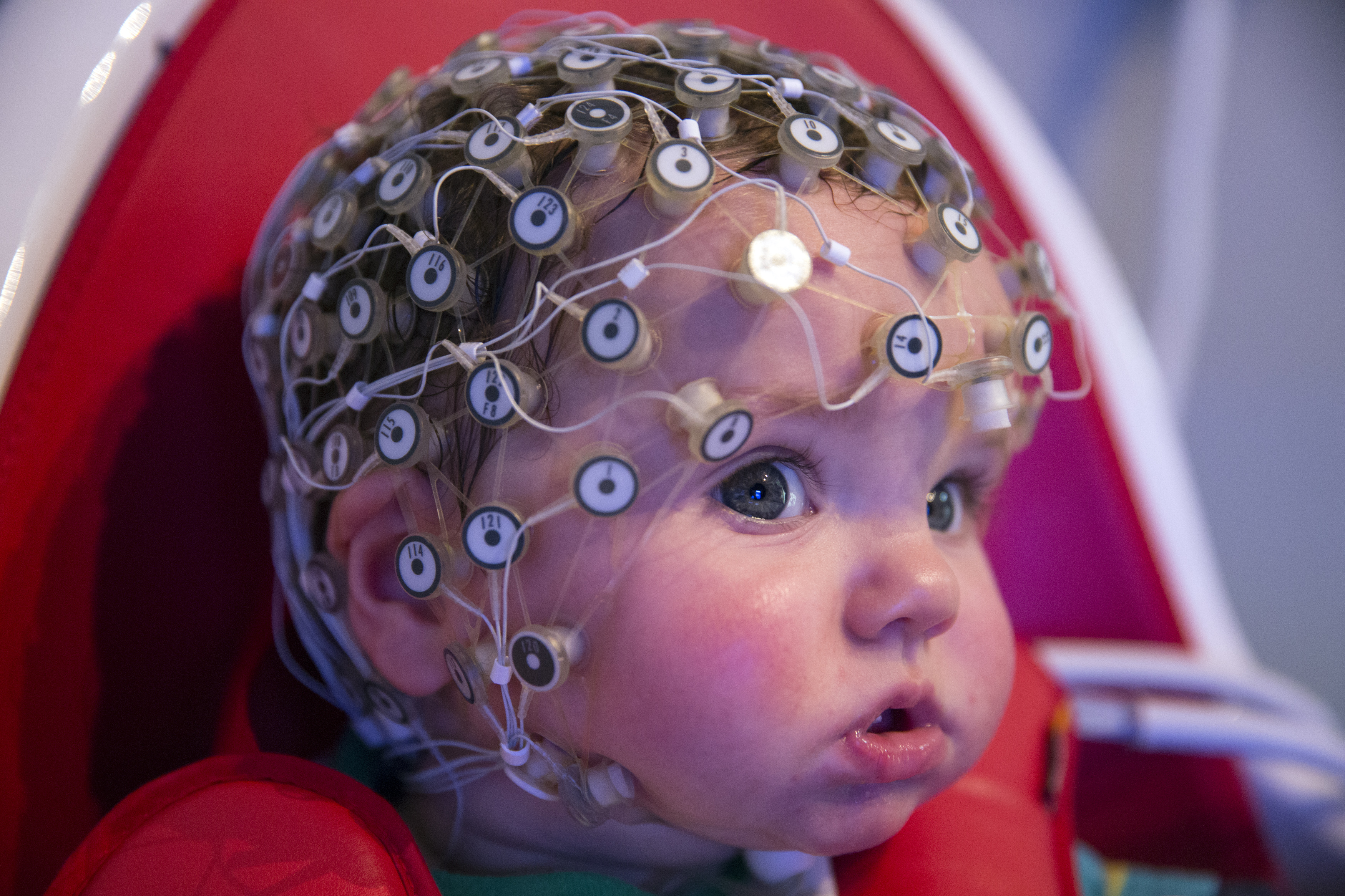Мозг ребенка видео. Электроэнцефалография (ЭЭГ). Электроэнцефалография головного мозга (ЭЭГ). ЭЭГ головного мозга ребенку. Микрополяризация ТКМП головного мозга.